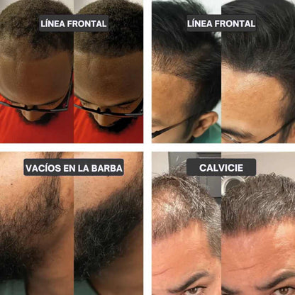 CUBRE CANAS Y ESPACIOS VISIBLES AL INSTANTE